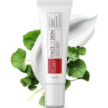 Sevimle Store Akne Kremi Yüz Için – Sivilce ve Akne Karşıtı Leke Kremi – Salisilik Asit & Niasinamid ile Leke Giderici – Genç ve Yetişkin Cilt Bakımı, 40 ml