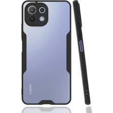 Mi 11 Lite Kılıf Platin Silikon - Siyah