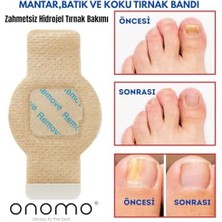 Onomo Tırnak Mantarı Bandı, Hidrojel Tırnak Bakımı 5 Adet