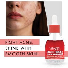 Vıtayes Aha%10 Bha%2 Kırmızı Peeling Cilt Serumu - Gözenek Sıkılaştırıcı, Cilt Canlandırıcı, Yenileyici, Ton Eşitleyici, Arındırıcı, Siyah Nokta ve Akne Karşıtı, Anti-Aging, Yaşlanma Karşıtı 30 ml