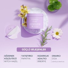 Foreo Kıwı Gözenek Minimizing Toner Pedleri 60 Adet – Witch Hazel & Centella Asiatica Peeling Yüz Pedleri, Yağ, Akne Taç Cilt Için – Gözenek Minimizer ve Redness Rölyef
