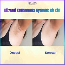 Elysian Essence Cilt Beyazlatıcı | Kararma Giderici Krem 3'lü Set - Genital Bölge, Koltuk Altı, Bikini Bölgesi, Dirsek ve Vücut 100 ml