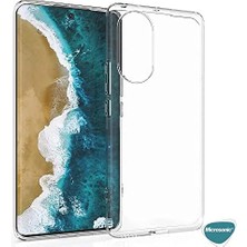 9 Için Kılıf Transparent Soft Beyaz [ 9 ile Uyumlu Kılıf - Beyaz]