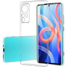 Novis Liora Newface Xiaomi Mi 12 Kılıf Lüx Şeffaf Silikon