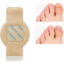 Onomo Tırnak Mantarı Bandı, Hidrojel Tırnak Bakımı 5 Adet