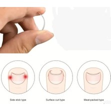 Ett Batık Tırnak Düzeltici Aparat Dinç Store - 004982