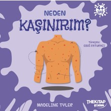 Neden Kaşınırım?