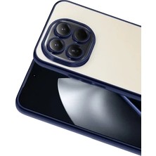 Zipax Xiaomi 15T Uyumlu Kılıf Silikon Lazer Lensli Kamera Korumalı Azn-Razer