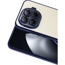 Zipax Xiaomi Mi 15T Pro Uyumlu Kılıf Silikon Lazer Lensli Kamera Korumalı Azn-Razer