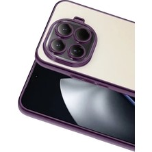 Zipax Xiaomi Mi 15T Pro Uyumlu Kılıf Silikon Lazer Lensli Kamera Korumalı Azn-Razer