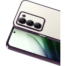 Zipax Xiaomi Redmi 15 4g Uyumlu Kılıf Silikon Lazer Lensli Kamera Korumalı Azn-Razer