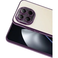 Zipax Xiaomi 15T Uyumlu Kılıf Silikon Lazer Lensli Kamera Korumalı Azn-Razer