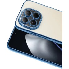 Zipax Xiaomi 15 Uyumlu Kılıf Silikon Lazer Lensli Kamera Korumalı Azn-Razer