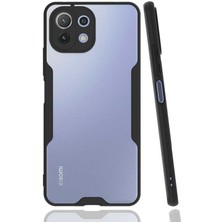 Oyo Store Xiaomi Mi 11 Lite Kılıf Oyo Parfe Kapak-Siyah