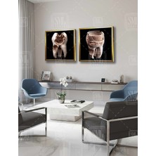 SML Tablo Diş Muayanehane Dental Sağlık Diş Hekimi Antik Tiyatro Ikili Kare Kombin 2li Çerçeveli Kanvas Tablo