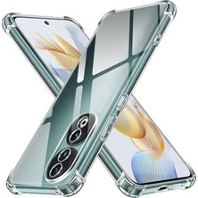 Kzy Honor 90 Kapak ile Uyumlu Kamera Korumalı Airbag Antishock Köşe Korumalı Şeffaf Silikon Kılıf