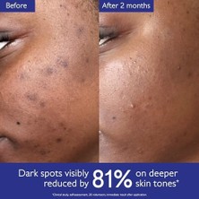 Karokstore Caudalie Vinoperfect Leke Karşıtı ve Işıltı Verici Serum 30 ml