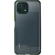Newface Xiaomi Mi̇ 11 Lite Kılıf Miami Şeffaf Silikon - Koyu Yeşil
