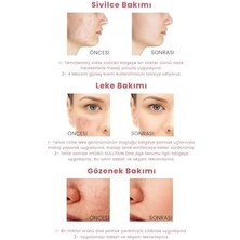 Procsın Hydro Solution Babypore Gözenek Sıkılaştırıcı & Canlandırıcı Tonik, %7 Glikolik Asit & Ginseng, Cilt Yenileyici & Arındırıcı, Tüm Cilt Tipleri Için, 200 ml