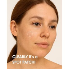 Stopever Clearly Spot Patch, Sivilce Karşıtı Şeffaf Plaster | Şeffaf, Ultra Ince, Hidrokolloid + Niacinamide + Salicylic Asit Içerikli Akne Karşıtı Yüz Bandı | 24 Adet