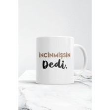 Mio Life Incinmişsin Dedi Baskılı Kupa Bardak