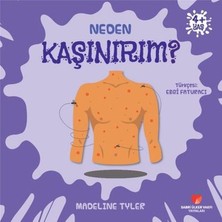 Neden Kaşınırım