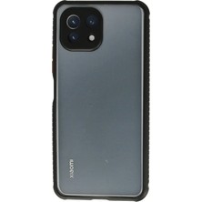 Zemira Newface Xiaomi Mi̇ 11 Lite Kılıf Miami Şeffaf Silikon - Siyah