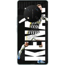 TechTree Honor X9C Uyumlu Kenan Yıldız Sevinç Baskılı Silikon Kılıf
