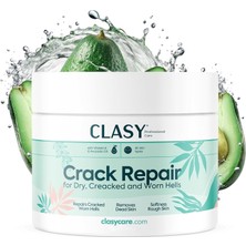 Shop A Way Topuk Çatlağı Kremi – Kuru ve Çatlamış Topuklar Için – E Vitamini ve Avokado Yağlı Topuk Kremi – Nas