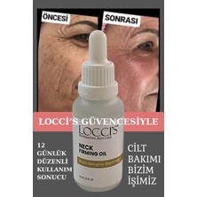 Locci's Cilt Sıkılaştırıcı Düzeltici Doğal Yağ Neck Fırmıng Oıl 30 ml