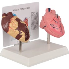 EgeAnatomi Maketleri Sağlıklı Kalp ve Sigara Içen Kalp Modeli - Kalp Maketi