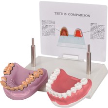 EgeAnatomi Maketleri Sağlıklı ve Sigara Içenlerin Ağız Sağlığı Eğitim Model - Ağız Maketi