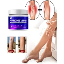 Vionex Süper Maximum Strength Varicose Vein Var.is Bacak Bakım Masaj Kremi 100 ml 2 Adet