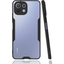 Newface Xiaomi Mi̇ 11 Lite Kılıf Platin Silikon - Siyah