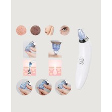 Toyigoo Güçlü Vakumlu Siyah Nokta Temizleyici – Cilt Pürüzlerini Gideren TYGOO-RSHB34