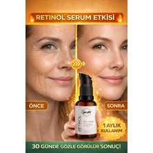 Giroflee Retinol Serum 30 ml – Anti-Aging, Kırışıklık Karşıtı ve Cilt Yenileyici Serum