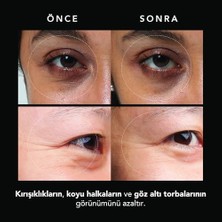 Faq Mikroiğneli Kırışıklık Karşıtı Hyaluronik Asit Göz Altı Pedleri – Göz Altı Şişlikleri ve Morluklara Karşı Pedler – Anında Etki – Seyahat Dostu – 3x2 Adet