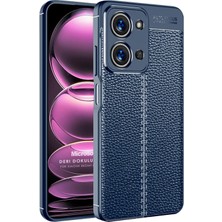 Microsonic Xiaomi Redmi 15C Kılıf Deri Dokulu Silikon Lacivert