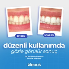 Diş Beyazlatma Bandı, Profesyonel Beyazlık, 14 Paket-28 Bant, Profesyonel Diş Beyazlatma Bandı, Günlük ve Bireysel Kullanıma Uygun