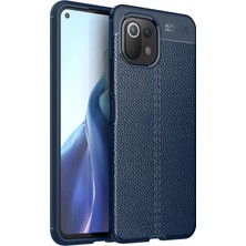 Xiaomi Mi 11 Lite Kılıf Auto Focus Kapak - Lacivert