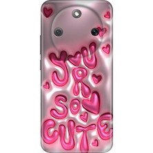 Senada Honor Magic 8 Lite Kılıf Desenli Baskılı Tpu Rubber Kapak CUTE111