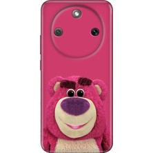 Senada Honor Magic 8 Lite Kılıf Desenli Baskılı Tpu Rubber Kapak Cottoncandy