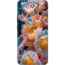 Honor Magic 8 Lite Kılıf Desenli Baskılı Tpu Rubber Kapak Okyanustaki Hayat