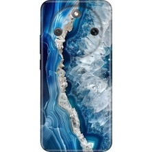 Honor Magic 8 Lite Kılıf Desenli Baskılı Tpu Rubber Kapak Otto Marble
