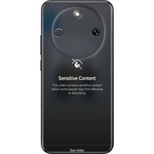 Honor Magic 8 Lite Kılıf Desenli Baskılı Tpu Rubber Kapak See Video