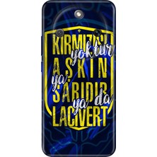 Nurdic Honor Magic 8 Lite Kılıf 0.4mm Lazer Kesim Silikon Kapak Aşkın Rengi Sarı Lacivert