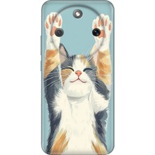 Senada Honor Magic 8 Lite Kılıf Desenli Baskılı Tpu Rubber Kapak Eller Yukarı