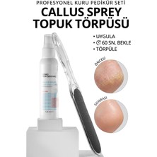 Normadia Pedikür Seti: Nasır Sökücü Sprey 125 ml ve Ayak Topuk Törpüsü