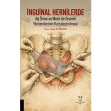 Inguinal Hernilerde Ağ Örme ve Mesh ile Onarım Yöntemlerinin Karşılaştırılması