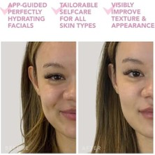 Skygo Ufo Mini 2 Power Maske ve Işık Terapi Cihazı